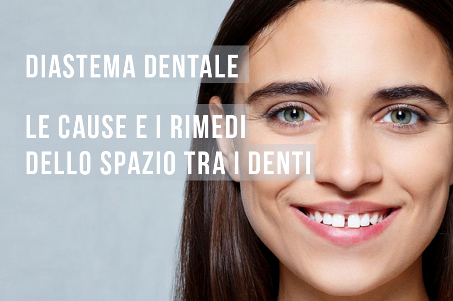 Diastema denti: cause e rimedi dello spazio tra i denti - Dentista a  Firenze - Dr. Marco Doccisi