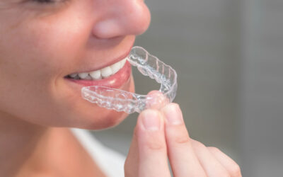 Apparecchio invisibile per denti storti: funziona davvero?